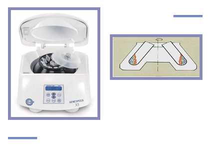 Hettich離心機蓋子打不開時的鎖扣與彈簧檢查